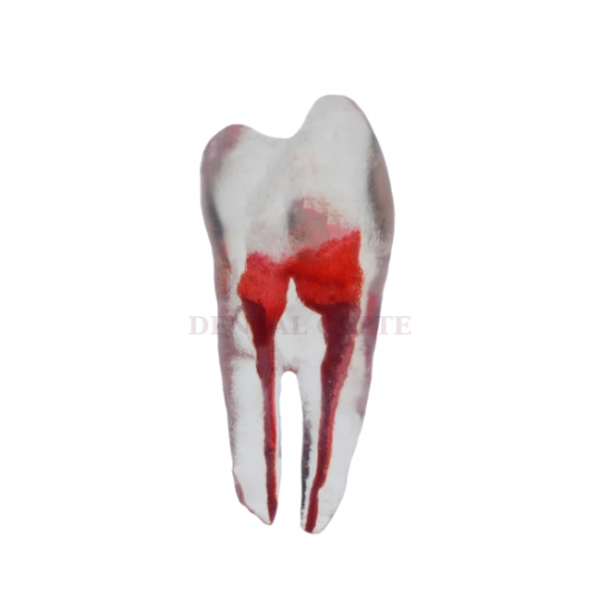 Endodonti Yapay Kanallı Diş - ÜST 1. PREMOLAR - 1Adet	